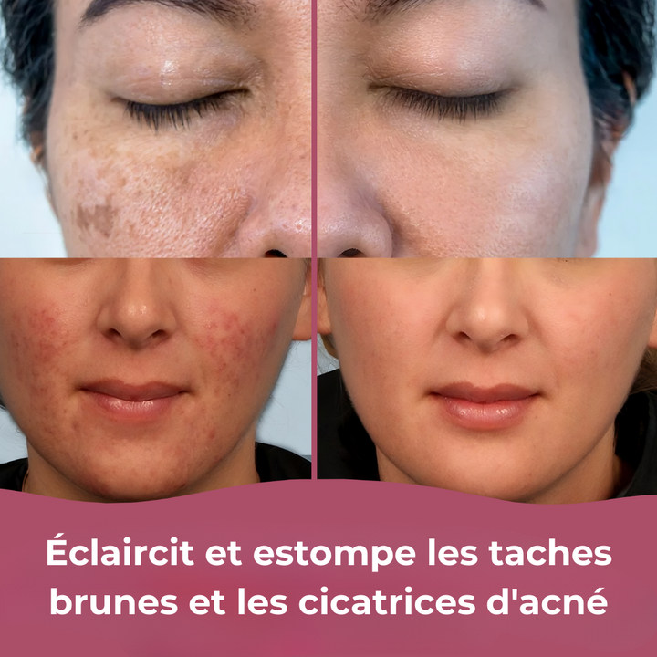 Orviva Sérum - Sérum pour une peau éclatante, hydratée et sublimée naturellement