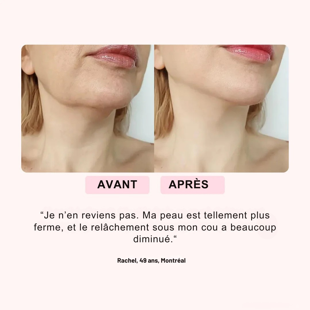 Koliza™ 2.0 – Masque LED Rajeunissant Visage & Cou