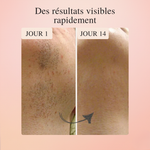 LumiSkin™ – L'épilateur #1 à lumière pulsée à domicile 2.0