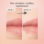 LumiSkin™ – L'épilateur #1 à lumière pulsée à domicile 2.0
