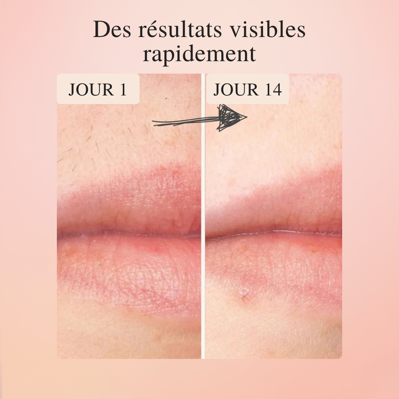 LumiSkin™ – L'épilateur #1 à lumière pulsée à domicile 2.0