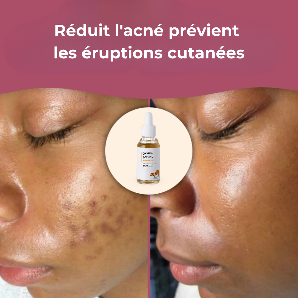 Orviva Sérum - Sérum pour une peau éclatante, hydratée et sublimée naturellement