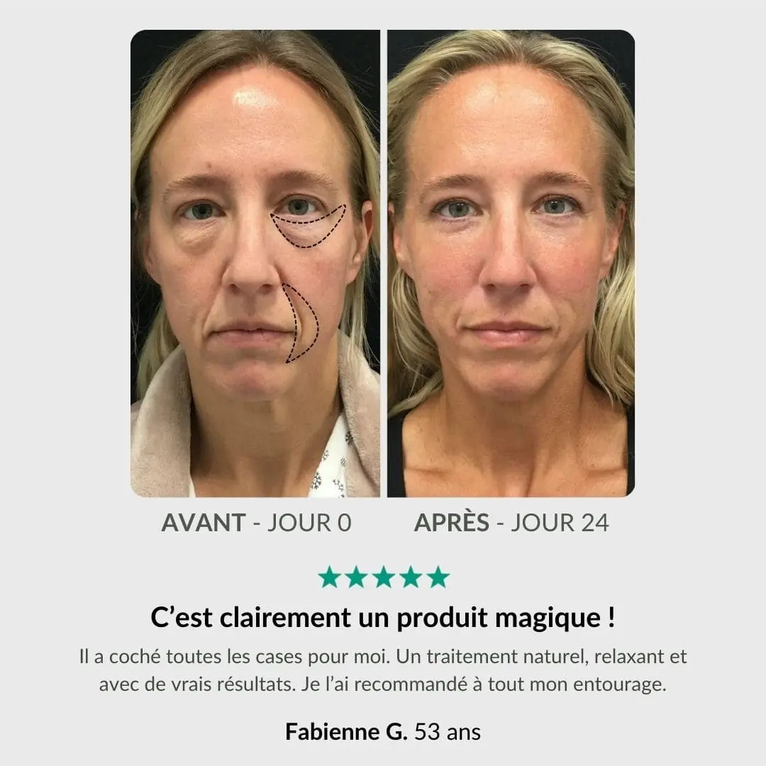 Pack Anti-Cernes LiftPro : Stylo & Sérum Activateur