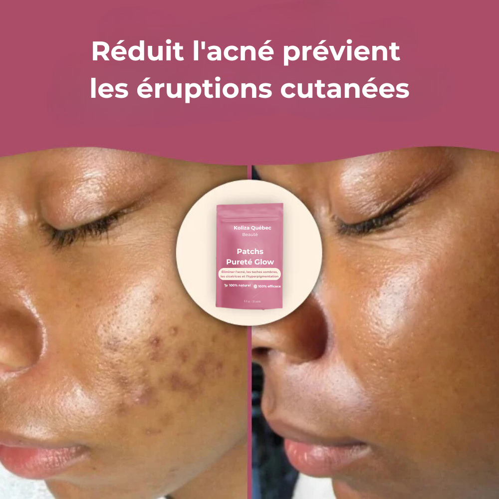 Cotons nettoyants Pureté Glow – Pour une peau lisse, pure et éclatante