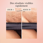 LumiSkin™ – L'épilateur #1 à lumière pulsée à domicile 2.0