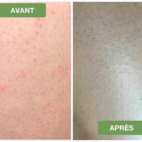 Gant Exfoliant - KolizaPro
