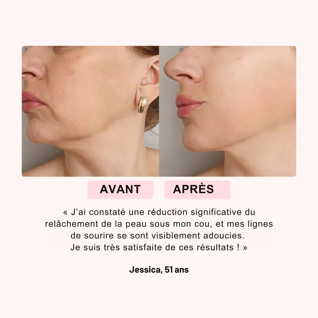 Renova™ – Masque LED Rajeunissant Visage & Cou