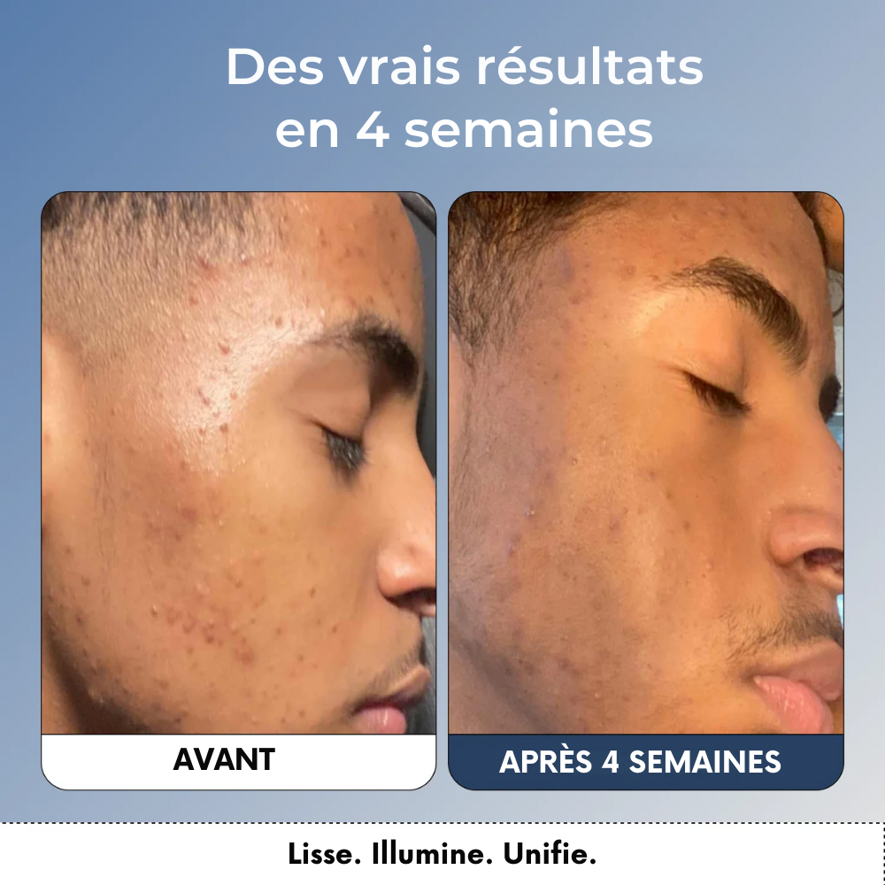 Nettoyant Éclora – Formule éclaircissante au curcuma & acide kojique