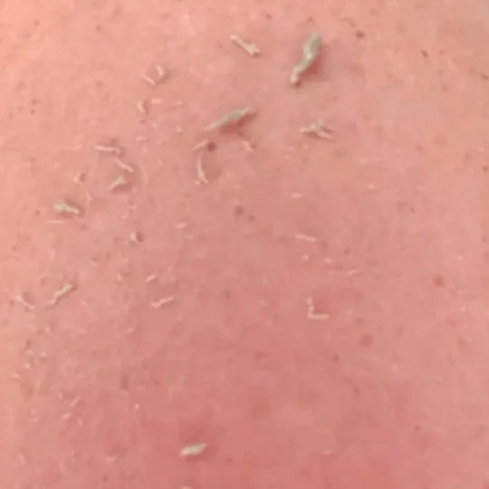 Gant Exfoliant - KolizaPro