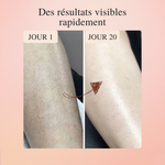 LumiSkin™ – L'épilateur #1 à lumière pulsée à domicile 2.0