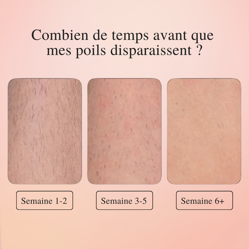 LumiSkin™ – L'épilateur #1 à lumière pulsée à domicile 2.0