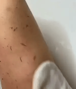 Gant Exfoliant - KolizaPro