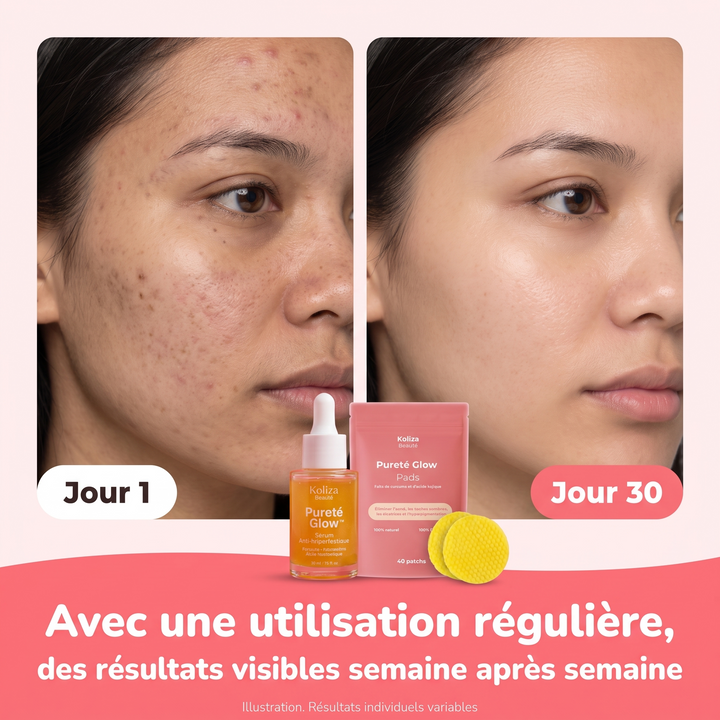 Routine Pureté Glow™ – Anti-Taches & Imperfections