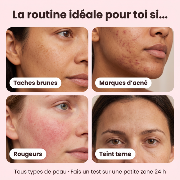 Routine Pureté Glow™ – Anti-Taches & Imperfections
