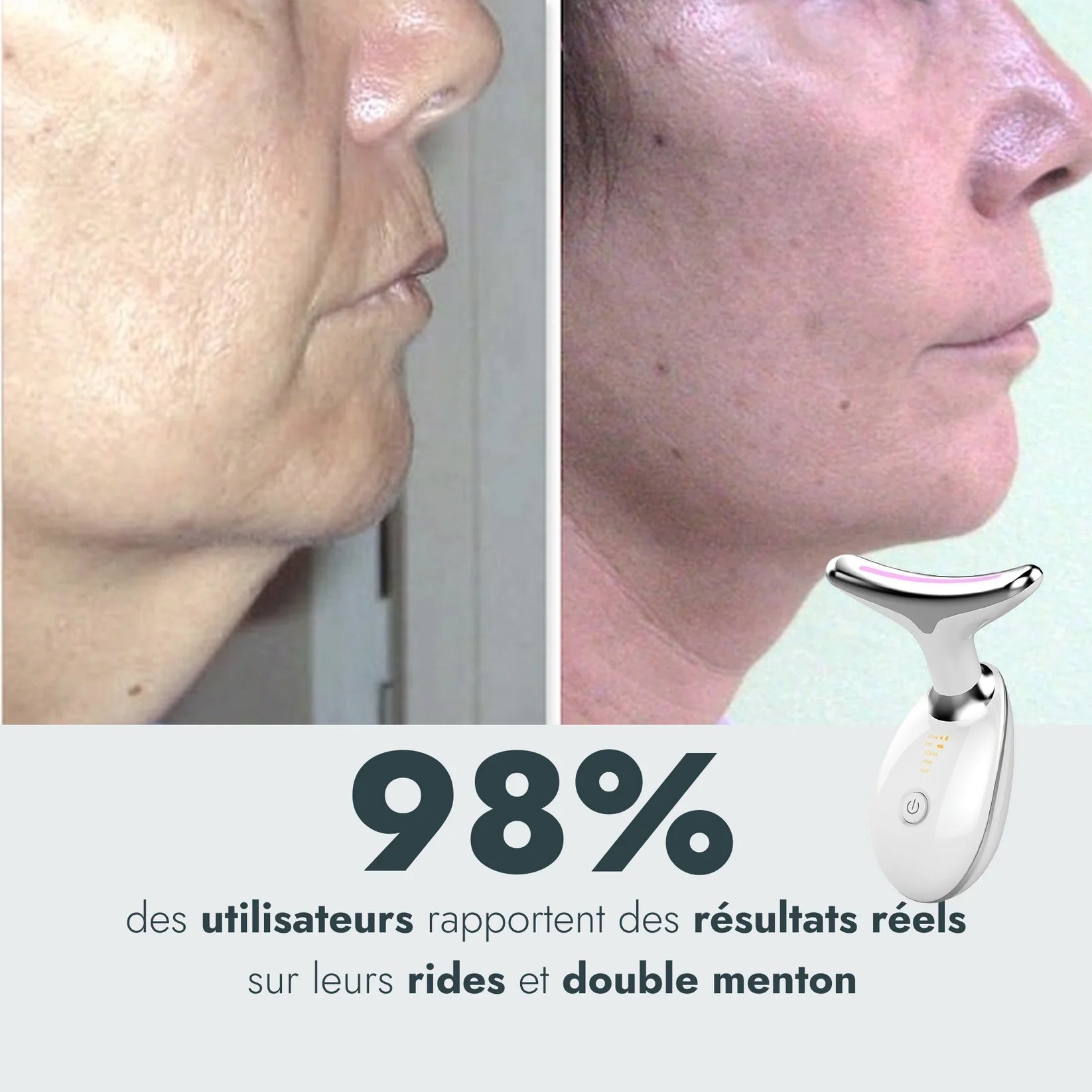 Masseur Noreska | Anti-acné et Anti-rides