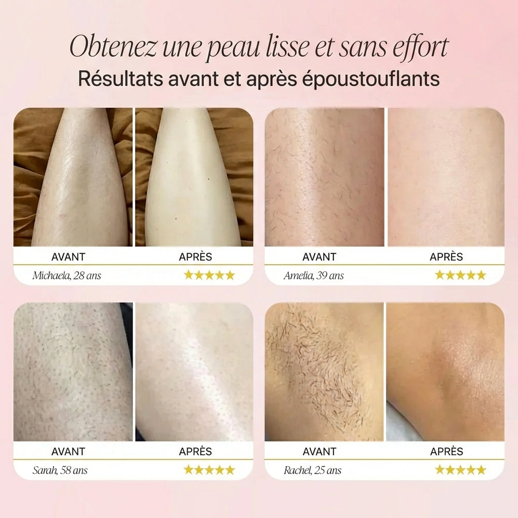 Le Rasoir Électrique Skinova